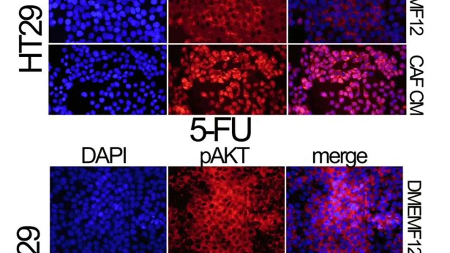 immunofluorescencia