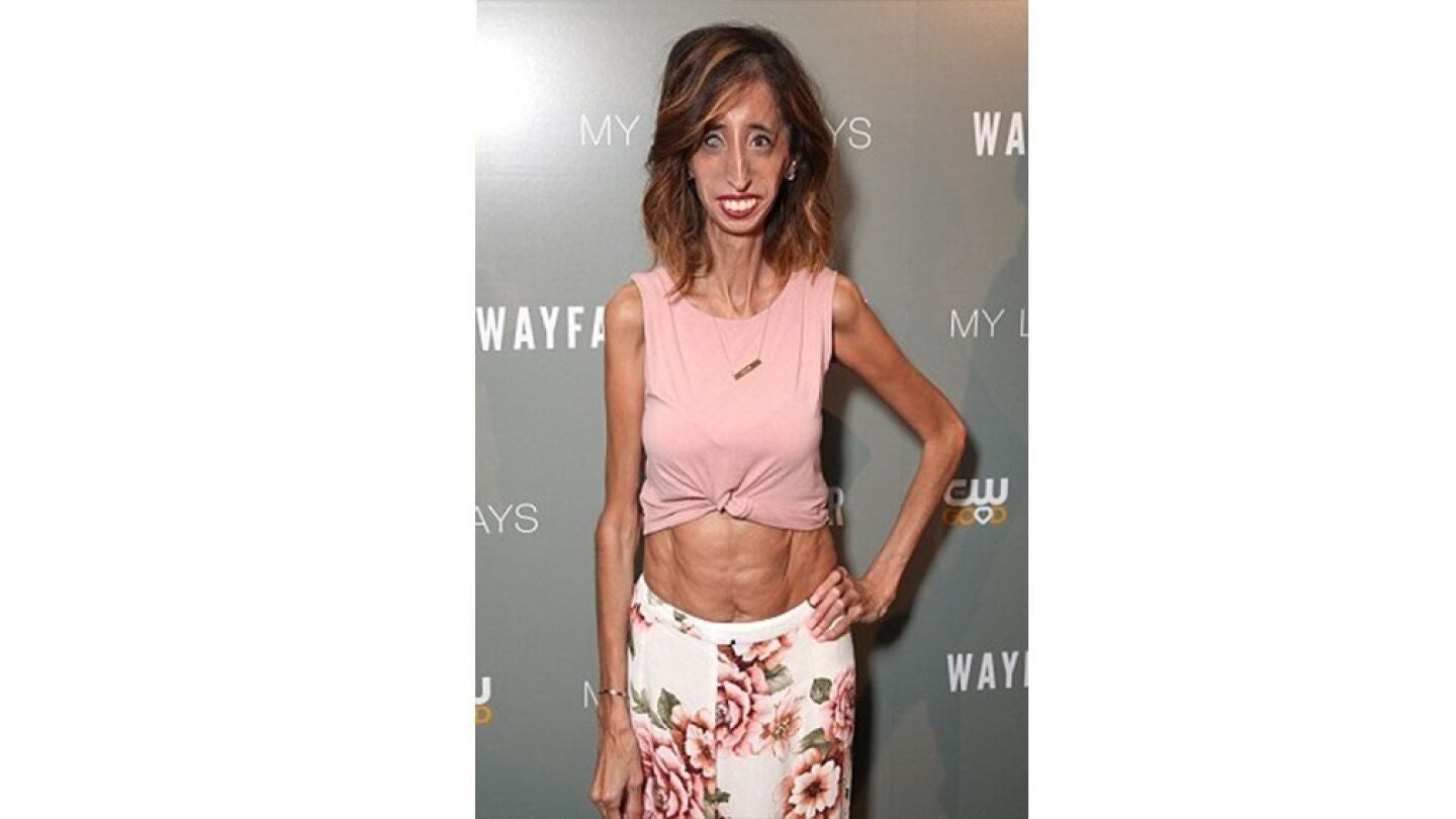 Lizzie Velasquez.