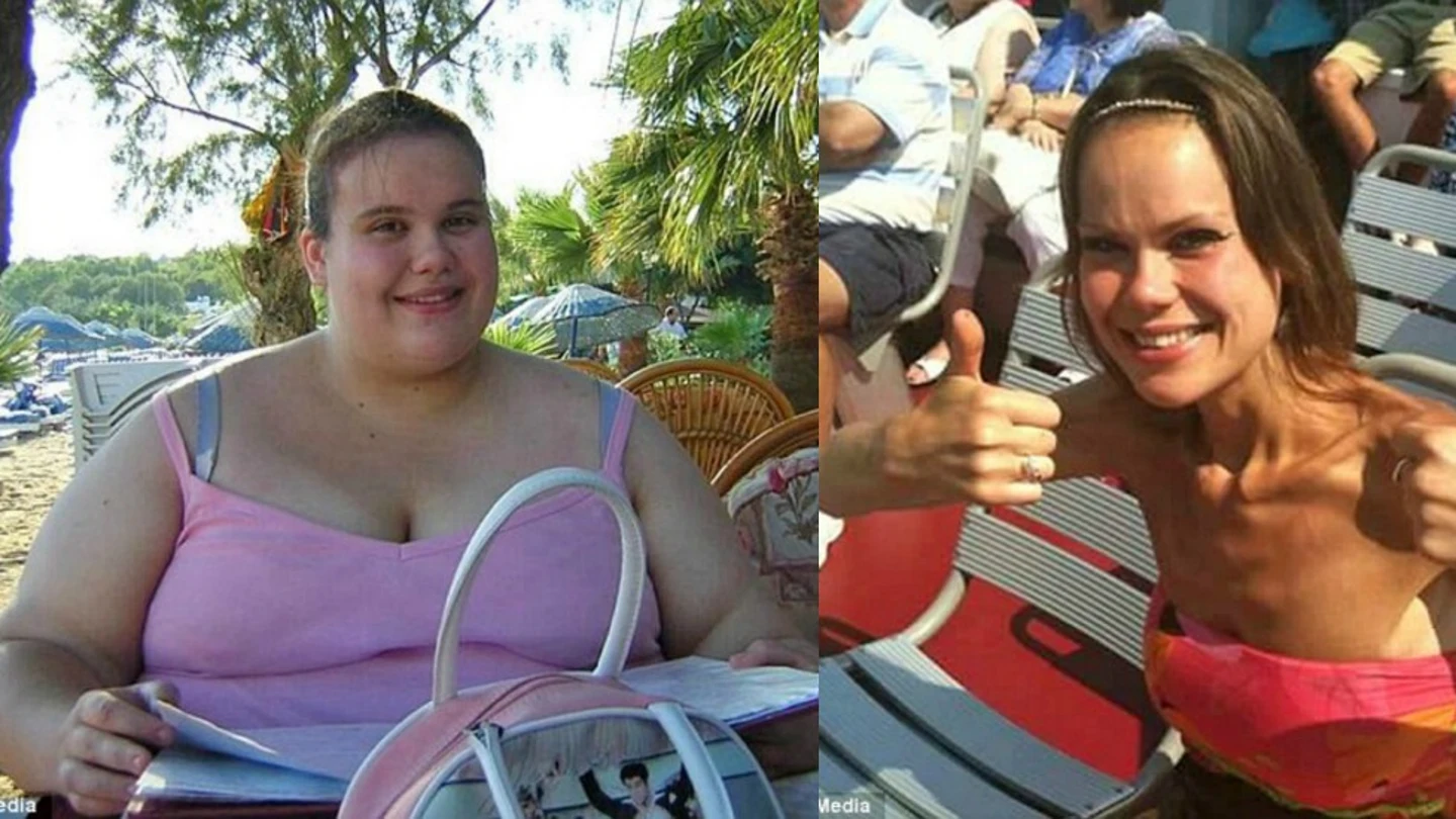 Lisa Milburn antes y después Lisa Milburn antes y después