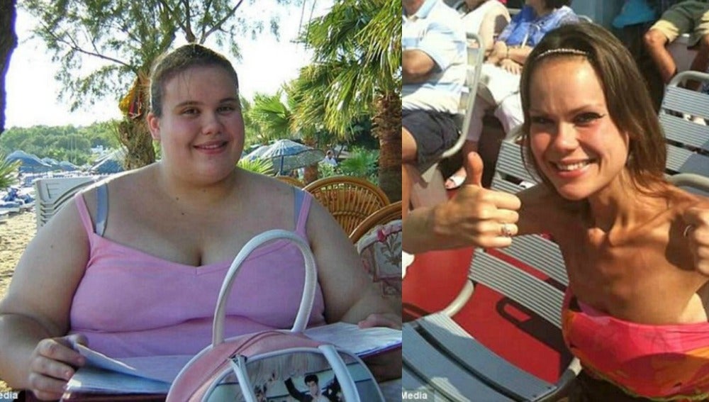 Lisa Milburn antes y después