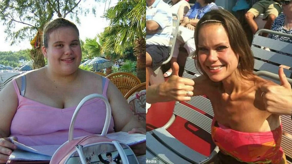 Lisa Milburn antes y después