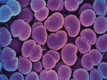 Neisseria gonorrhoeae, la bacteria que provoca la gonorreaNeisseria gonorrhoeae, la bacteria que provoca la gonorrea Neisseria gonorrhoeae, la bacteria que provoca la gonorreaNeisseria gonorrhoeae, la bacteria que provoca la gonorrea