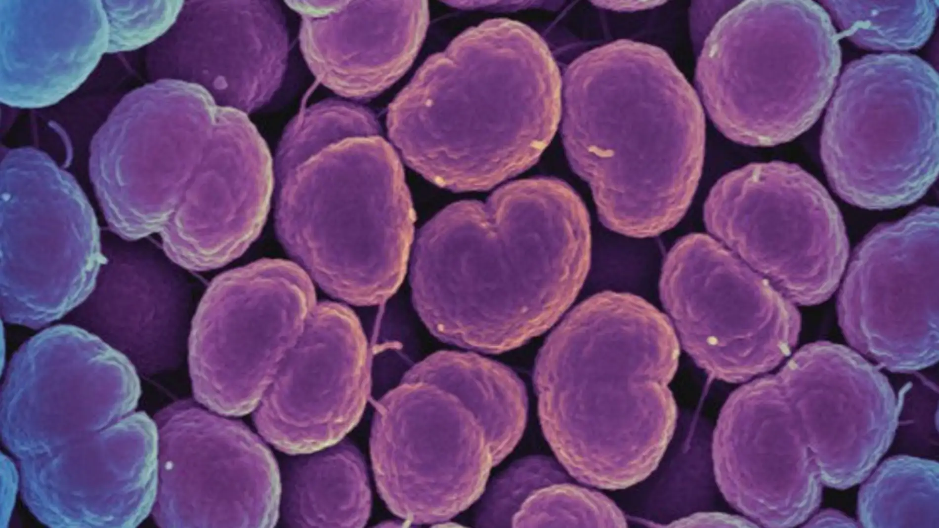 Neisseria gonorrhoeae, la bacteria que provoca la gonorreaNeisseria gonorrhoeae, la bacteria que provoca la gonorrea