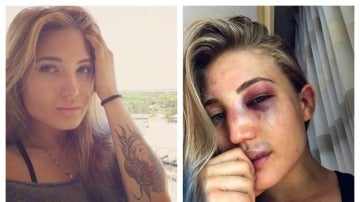 Anastasia Yankova, muestra como quedo su rostro tras un combate de MMA