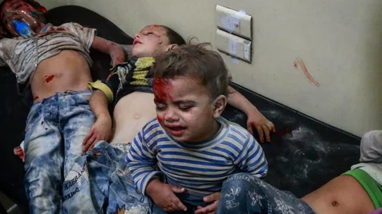 Niños heridos tras un ataque en Alepo Niños heridos tras el ataque en Alepo.