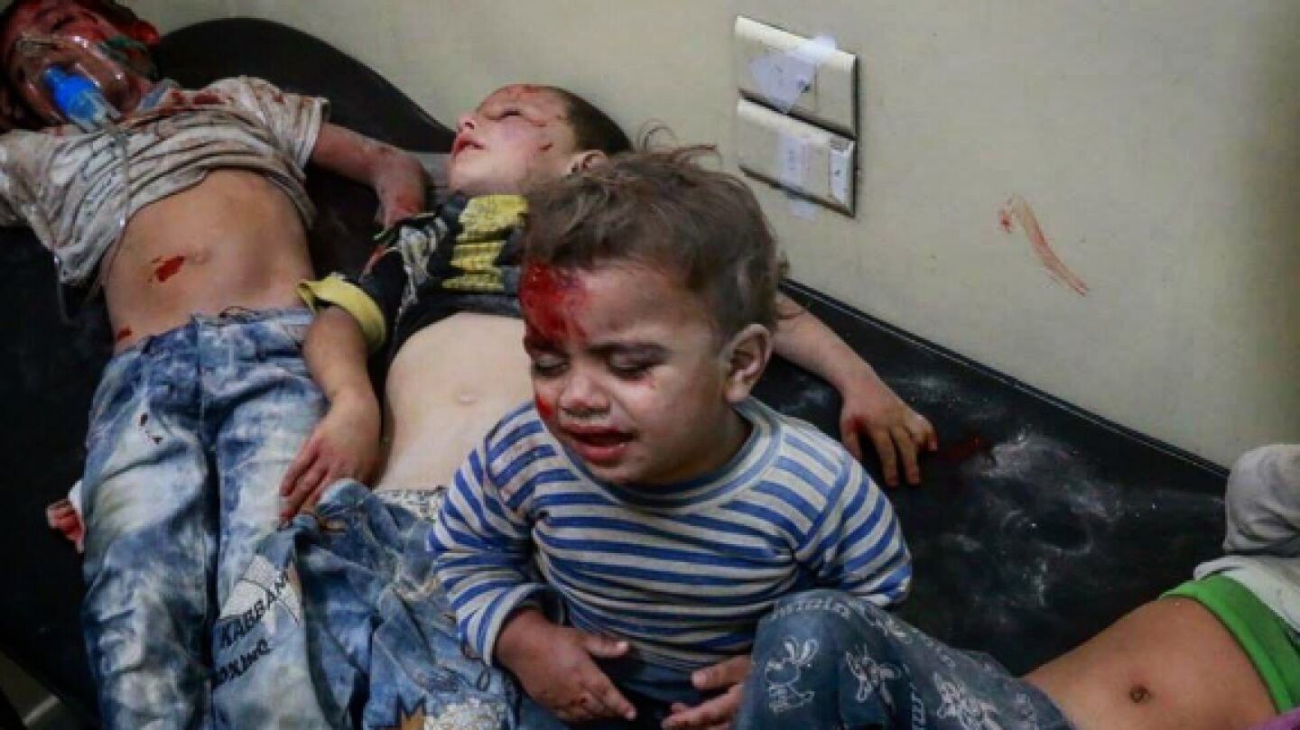 Ni&ntilde;os heridos tras el ataque en Alepo.