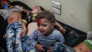 Niños heridos tras un ataque en Alepo