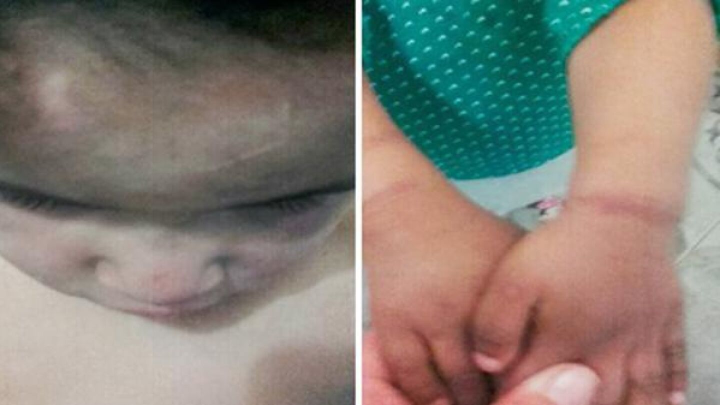 Los ni&ntilde;os maltratados en Argentina