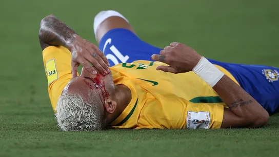 Neymar se lleva la mano a la cara tras el codazo de Duk Neymar se lleva la mano a la cara tras el codazo de Duk
