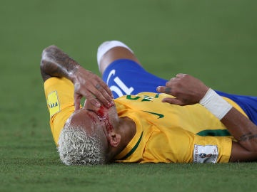 Neymar se lleva la mano a la cara tras el codazo de Duk Neymar se lleva la mano a la cara tras el codazo de Duk