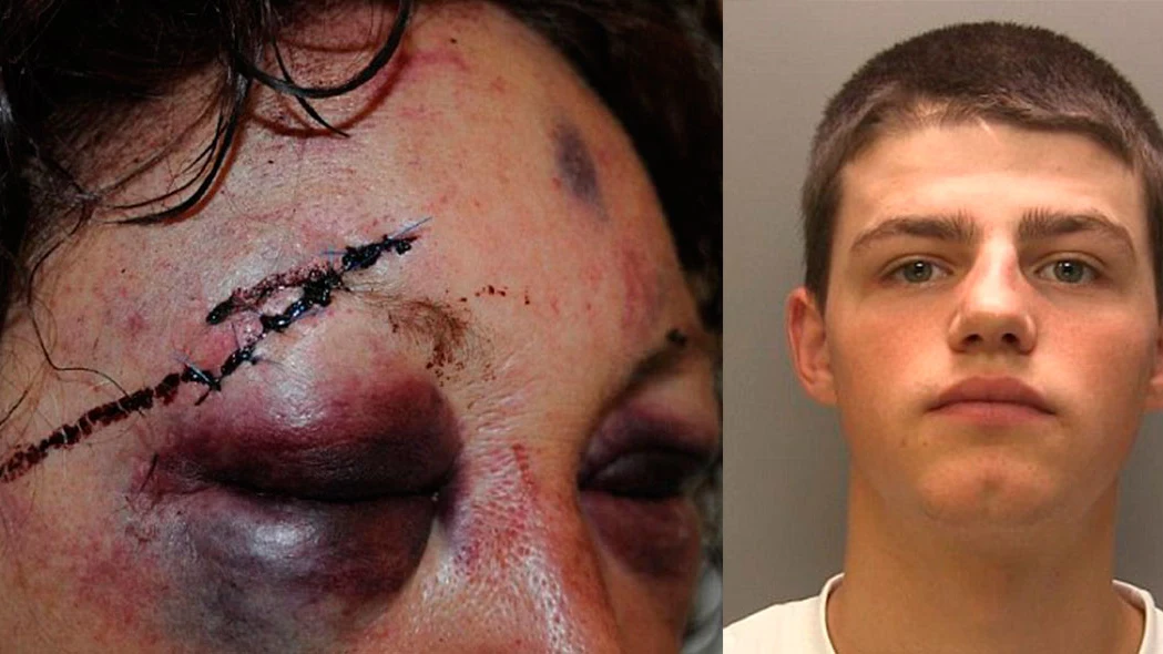 Imagen de la mujer agredida y su agresor, Jack Walker
