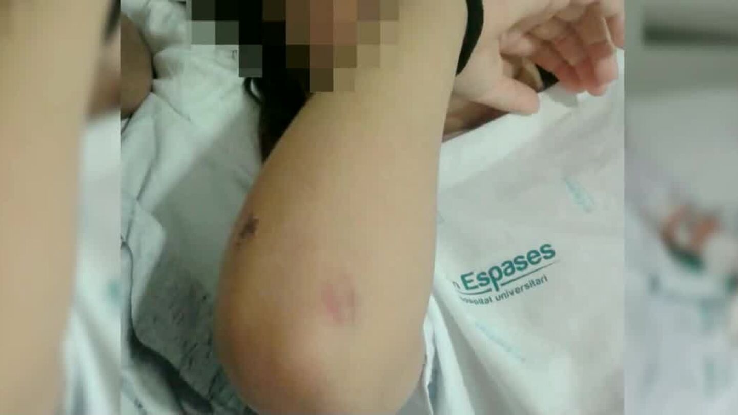Menor de ocho a&ntilde;os apaleada en un colegio de Palma