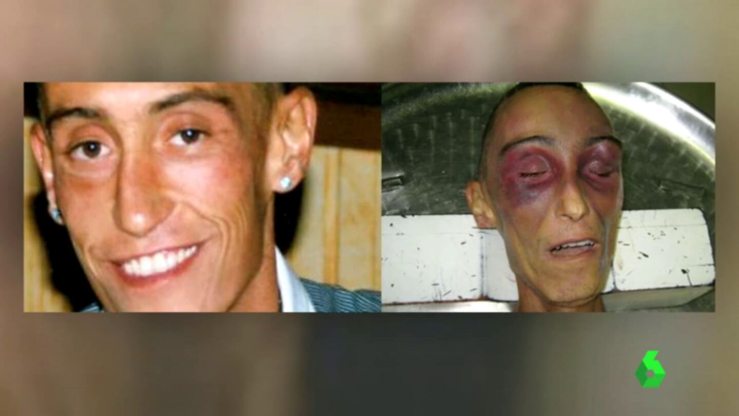 Frame 20.024208 de: Un informe sobre la muerte de Stefano Cucchi comienza a dar la raz&oacute;n a la familia: "Su imagen hace pensar en tortura"