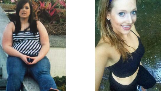 Emma antes y despu&eacute;s de adelgazar