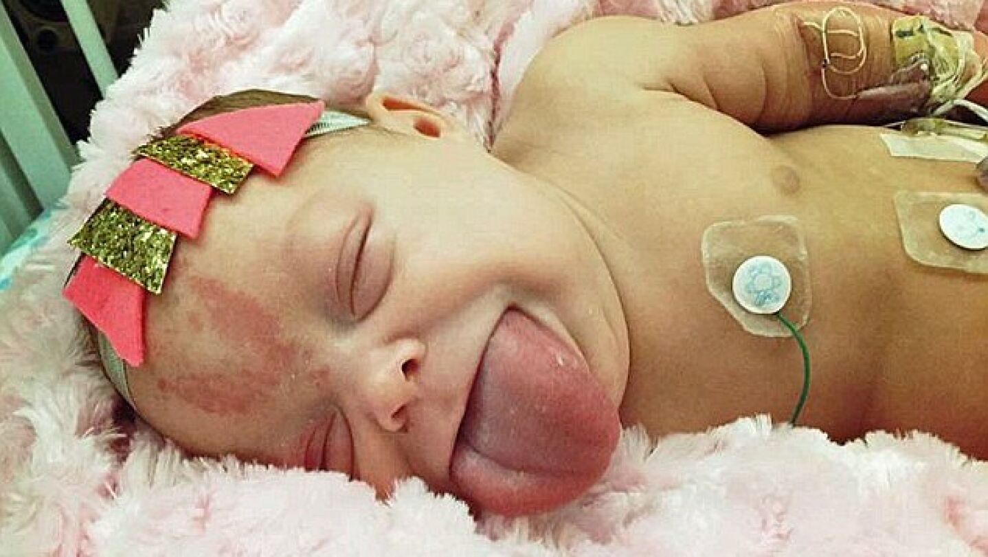 Paisley Morrison-Johnson antes de ser operada