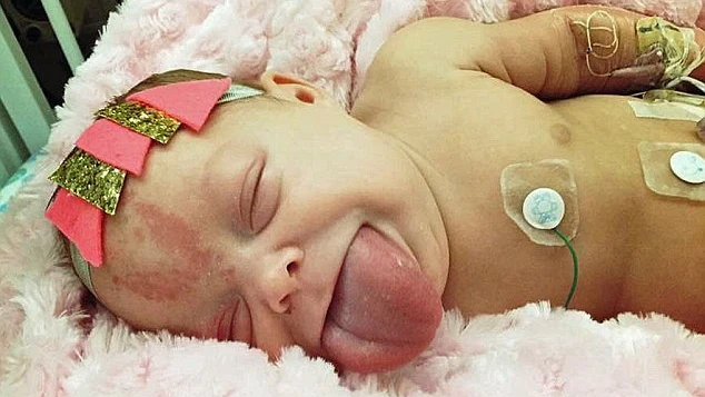 Paisley Morrison-Johnson antes de ser operada