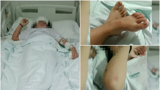 Imágenes de la niña agredida en Palma Imágenes de la niña agredida en Palma