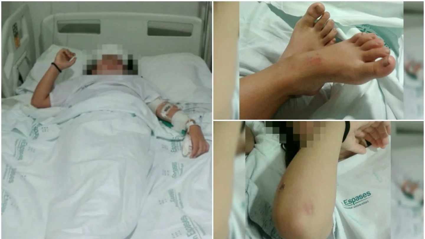 Imágenes de la niña agredida en Palma Imágenes de la niña agredida en Palma