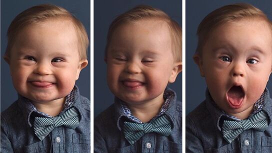 Asher en la campa&ntilde;a 'Cambiando la cara de la belleza'