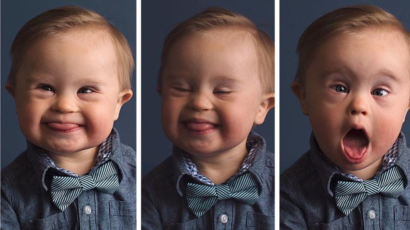 Asher en la campa&ntilde;a 'Cambiando la cara de la belleza'