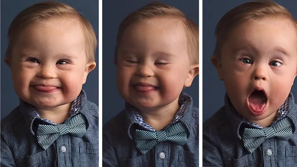 Asher en la campaña 'Cambiando la cara de la belleza'