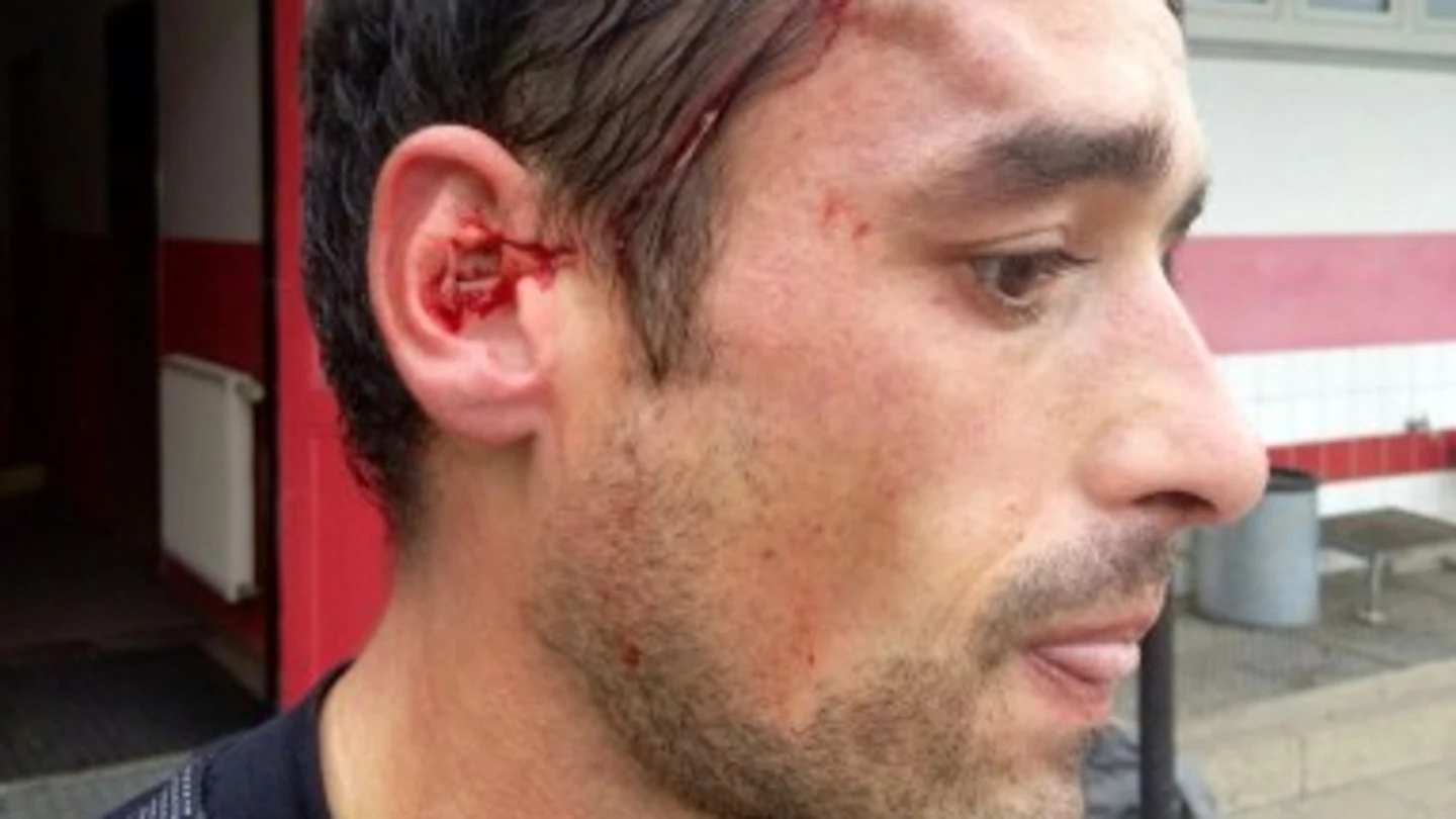 Alberto Mier Sañudo, futbolista español Alberto Mier Sañudo, futbolista español