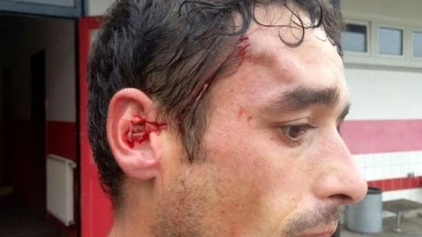 Alberto Mier Sañudo, futbolista español Alberto Mier Sañudo, futbolista español