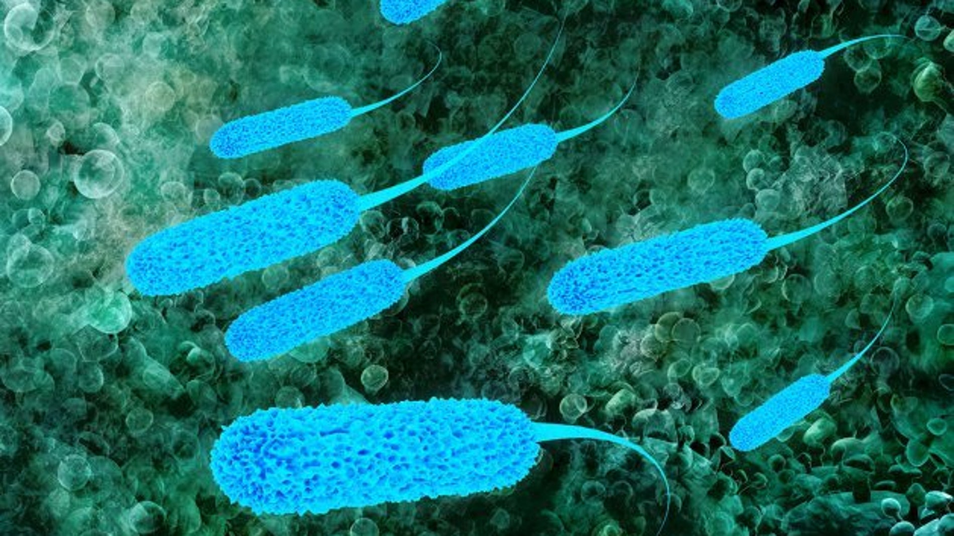 Microbios