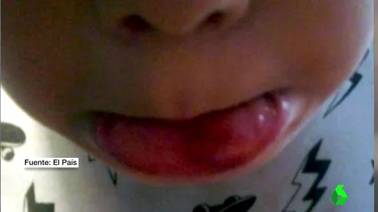 Imagen del menor de Sevilla agredido Imagen del menor de Sevilla agredido