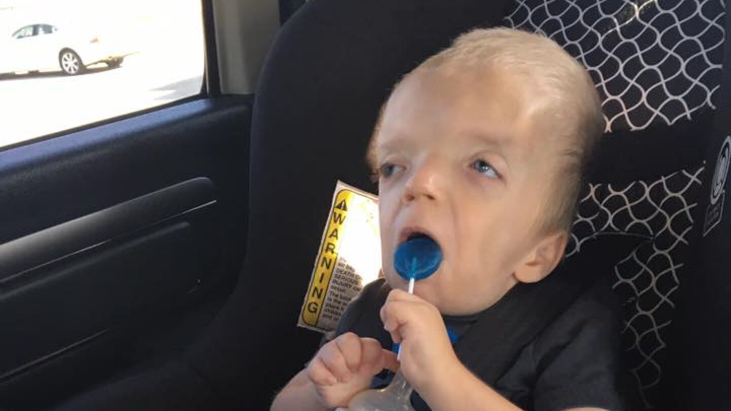 Grayson, el ni&ntilde;o con enfermedad terminal del que se est&aacute;n haciendo memes