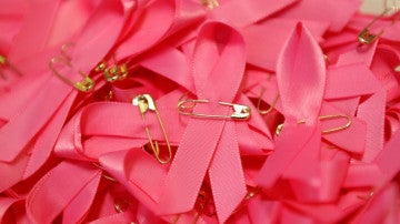  En España se diagnostican alrededor de 27.000 nuevos casos de cáncer de mama anuales 