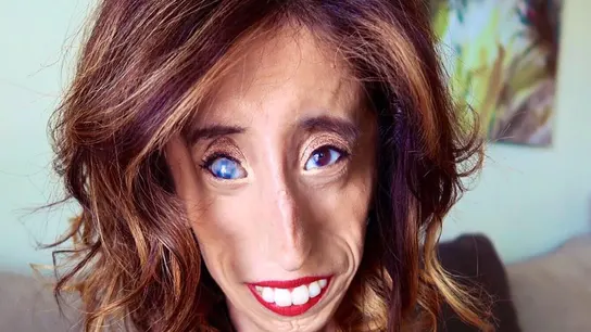 Lizzie descubrió que estaban usando su imagen en un 'meme' Lizzie descubrió que estaban usando su imagen en un 'meme'