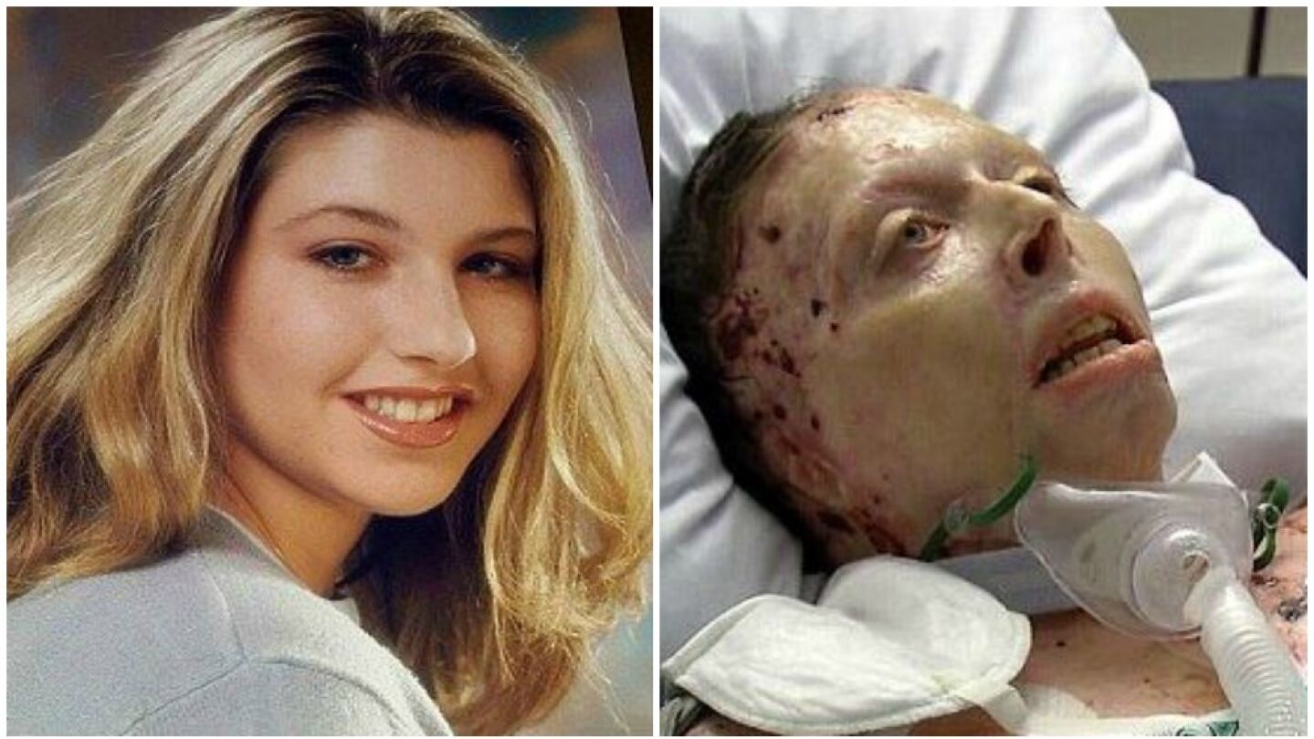 Judy Malinowski antes y despu&eacute;s de sufrir el ataque de su expareja