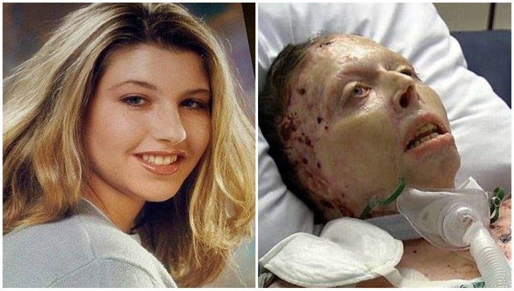 Judy Malinowski antes y después de sufrir el ataque de su expareja
