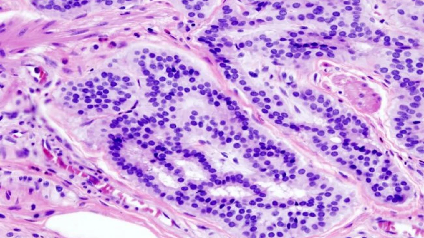 Científicos españoles ensayarán en 2017 un anticuerpo humanizado contra varios tumores cancerígenos Científicos españoles ensayarán en 2017 un anticuerpo humanizado contra varios tumores cancerígenos