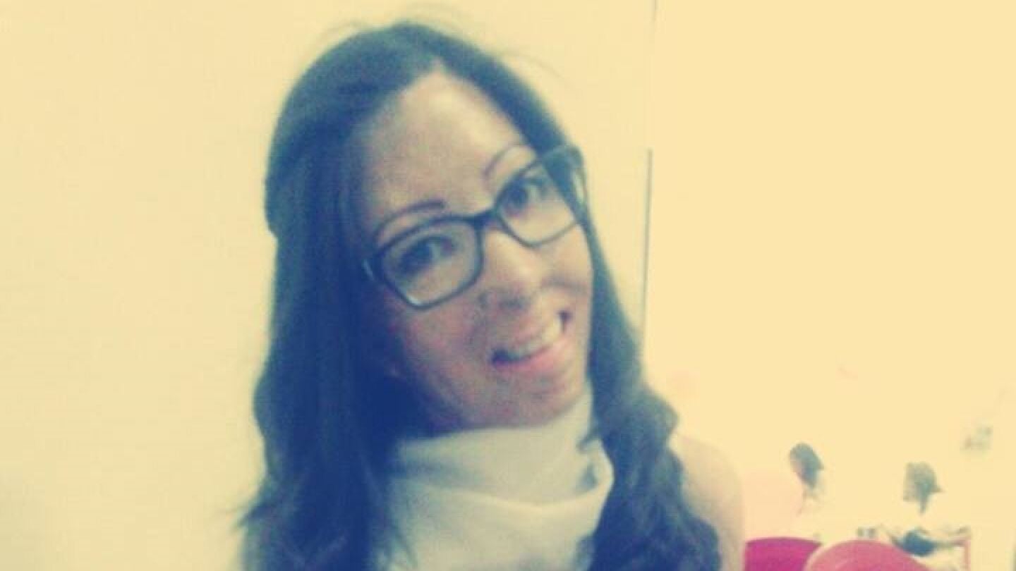Jenifer Segovia, una joven que sufri&oacute; quemaduras en el 47 por ciento del cuerpo durante un incendio provocado por su padrastro cuando ella ten&iacute;a 10 a&ntilde;os