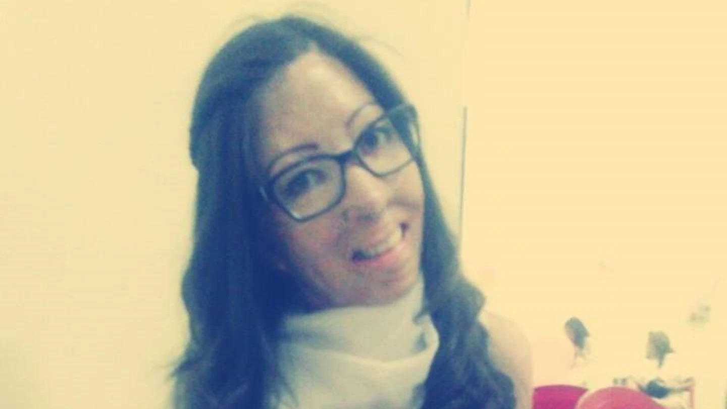 Jenifer Segovia, una joven que sufrió quemaduras en el 47 por ciento del cuerpo durante un incendio provocado por su padrastro cuando ella tenía 10 años Jenifer Segovia, una joven que sufrió quemaduras en el 47 por ciento del cuerpo durante un incendio provocado por su padrastro cuando ella tenía 10 años