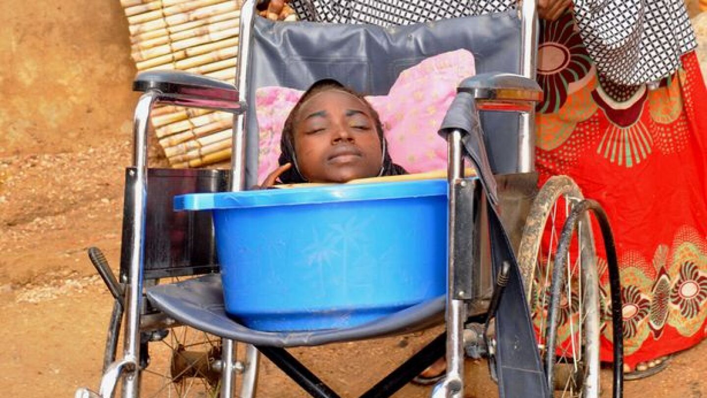 Rahma Haruna, la joven sin extremidades