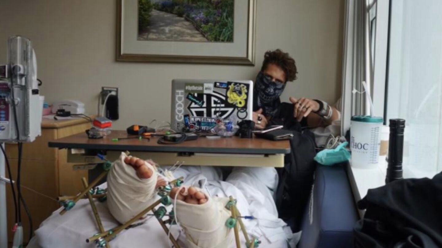 El 'youtuber' 8Booth, tras fracturarse los dos tobillos