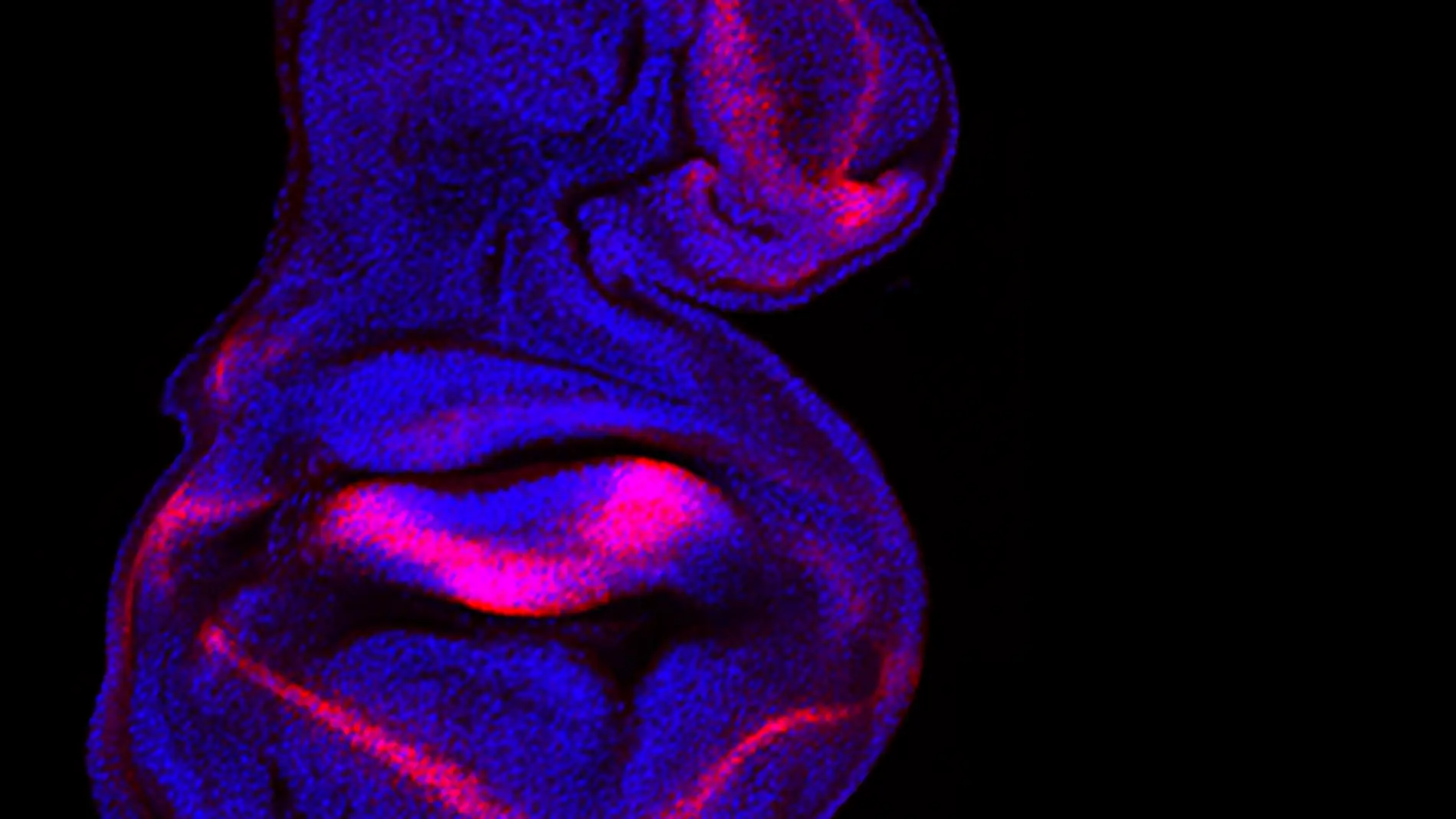 Malformaciones en el ala de Drosophila