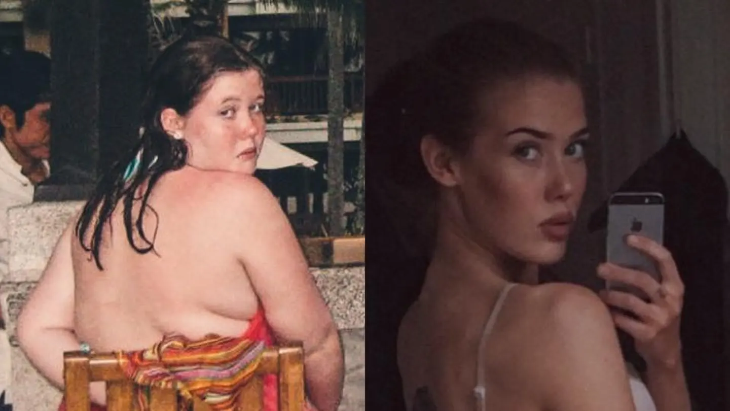 El antes y después de Mathilde Broberg El antes y después de Mathilde Broberg