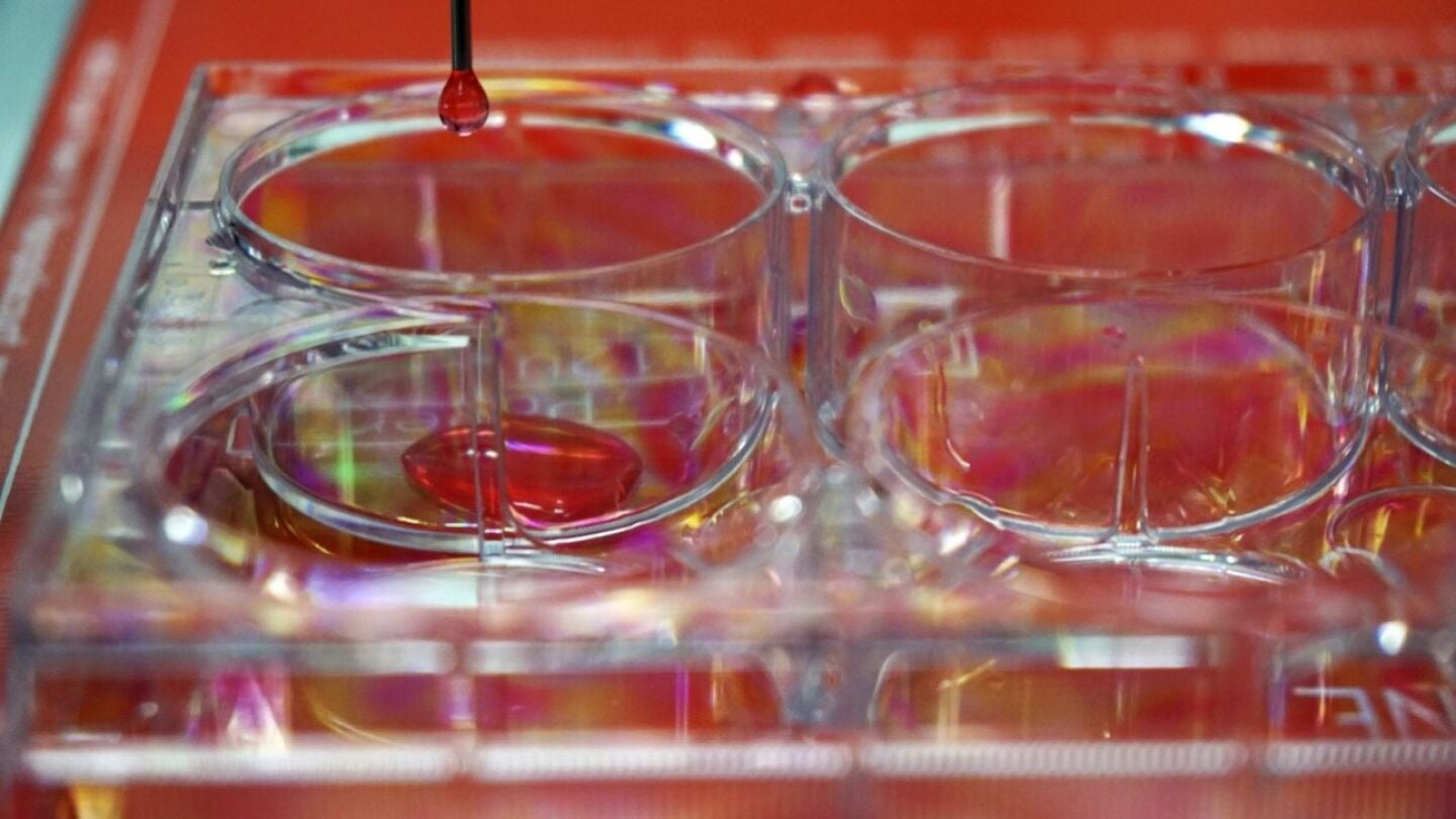 Bioimpresora 3D de piel humana