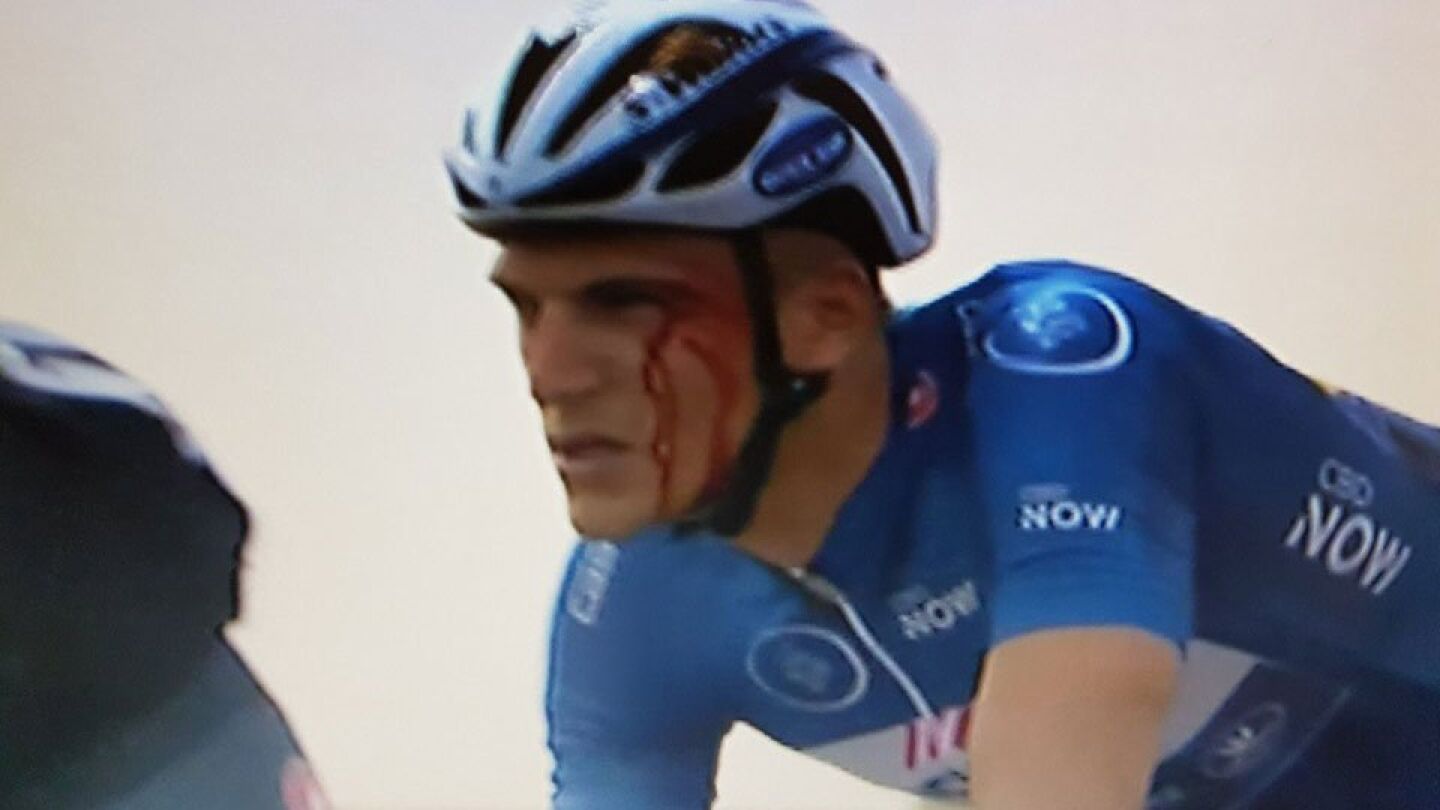 Kittel sangrando durante la carrera tras el pu&ntilde;etazo de Krivko