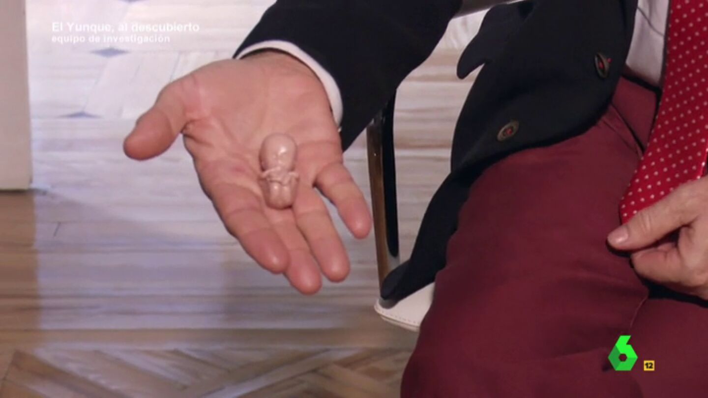 Frame 137.477707 de: Andr&eacute;s Perell&oacute;, eurodiputado: "Remit&iacute;an una carta con un feto de pl&aacute;stico y una nota que dec&iacute;a que eso era lo que se mata si hay un aborto"