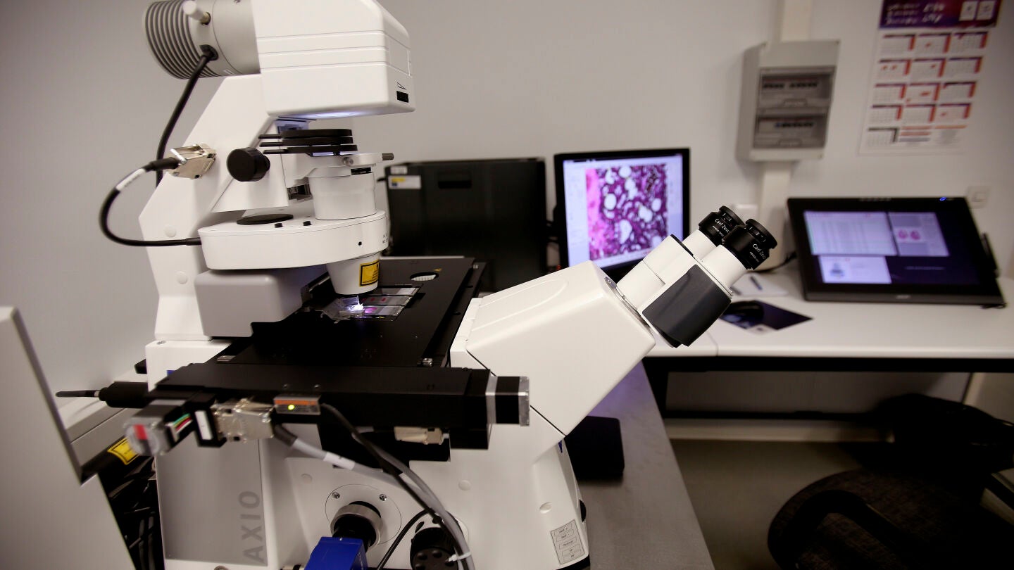 Microscopio l&aacute;ser que da informaci&oacute;n concreta sobre c&eacute;lulas tumorales"del Servicio de Patolog&iacute;a Molecular Comparada de Salamanca
