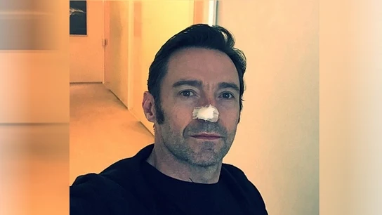 Hugh Jackman revela que ha sido operado de nuevo por cáncer de piel Hugh Jackman revela que ha sido operado de nuevo por cáncer de piel