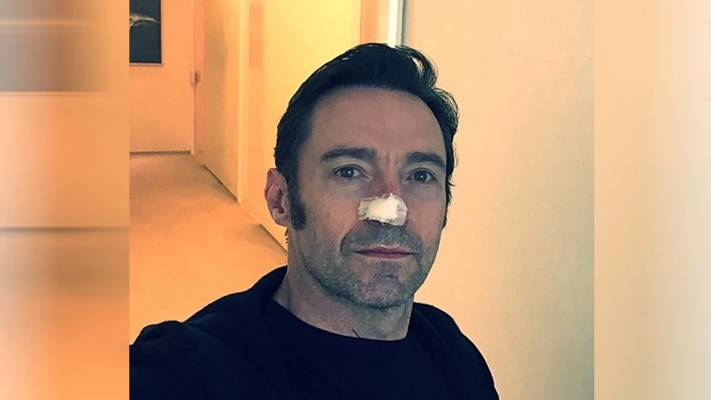 Hugh Jackman revela que ha sido operado de nuevo por cáncer de piel