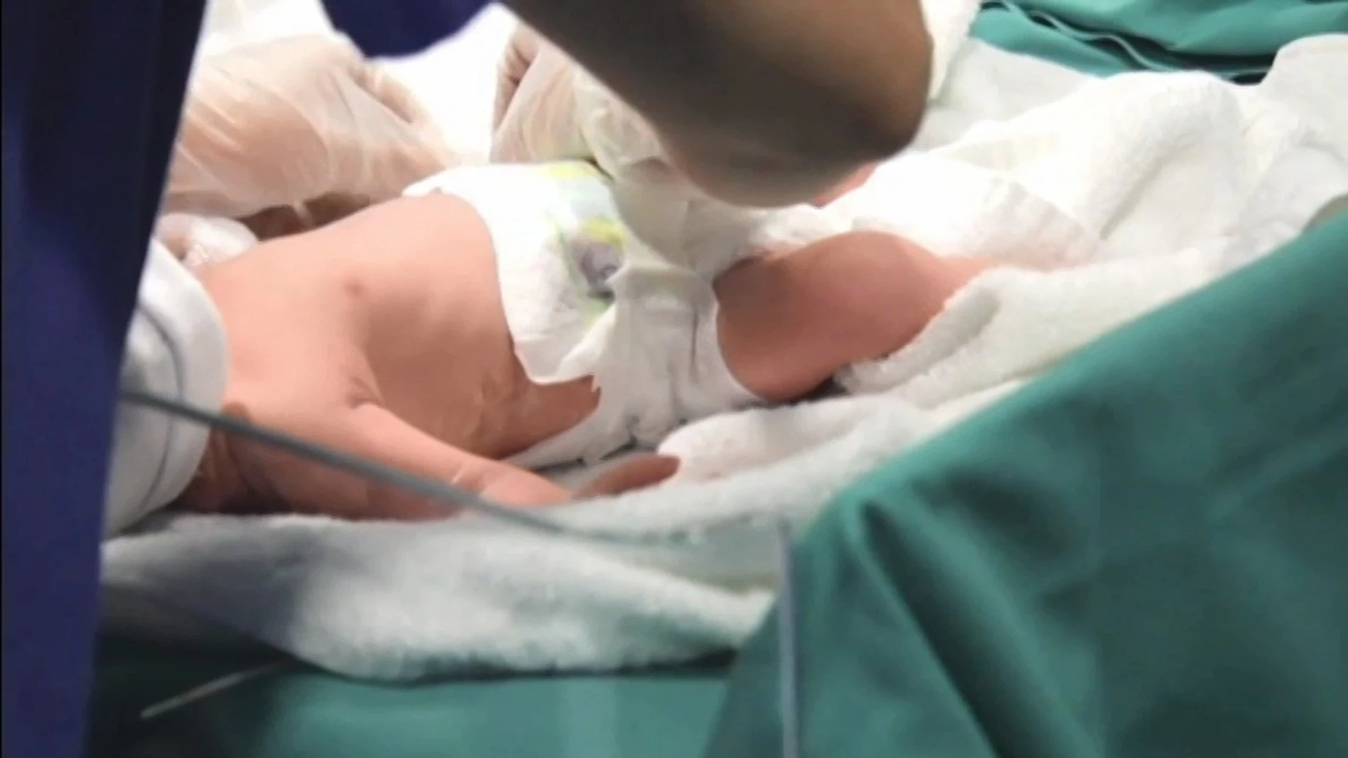 Imagen tomada del vídeo del parto cedido por Recoletas Red Hospitalaria