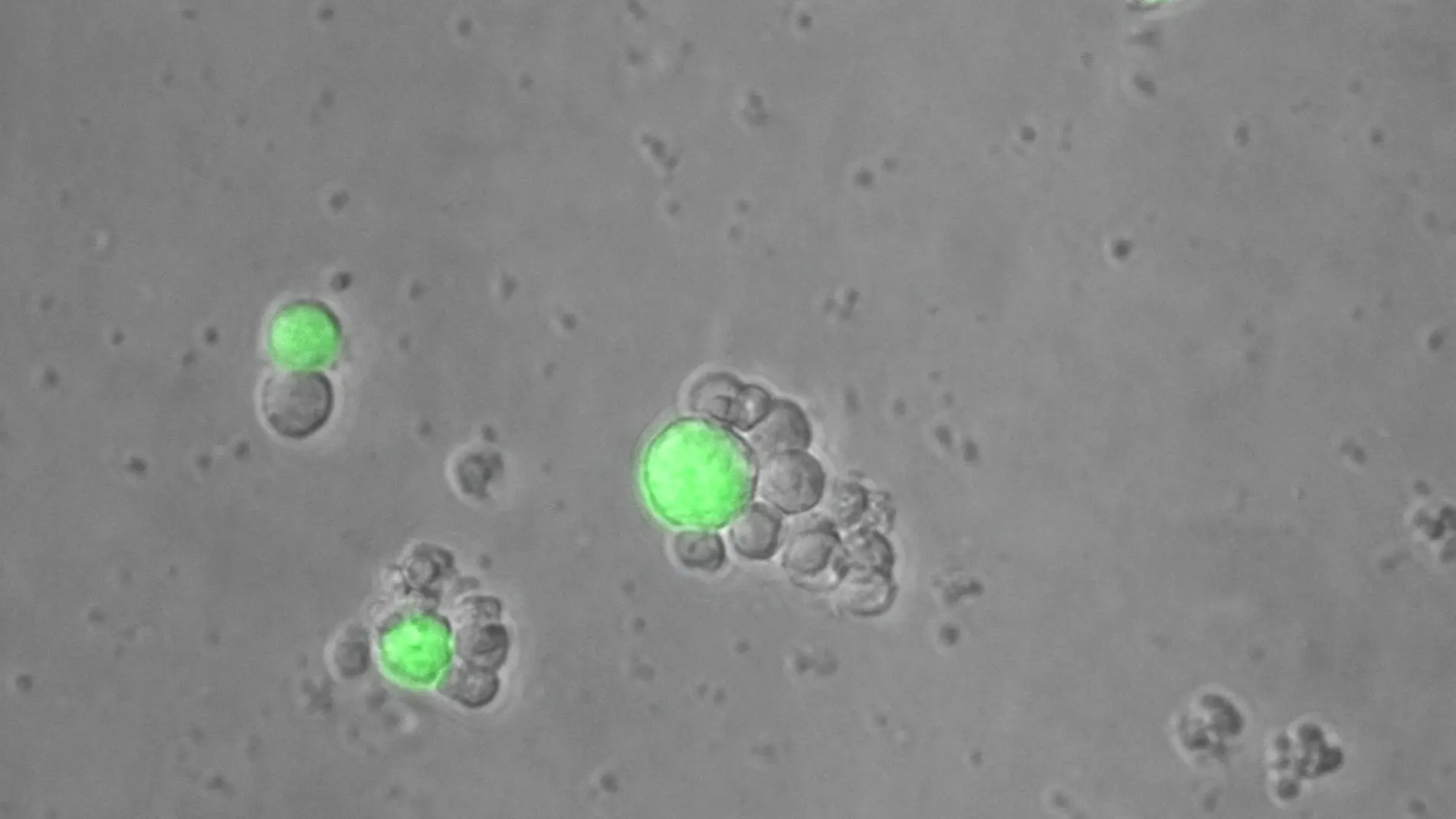 Células T atacando tumor