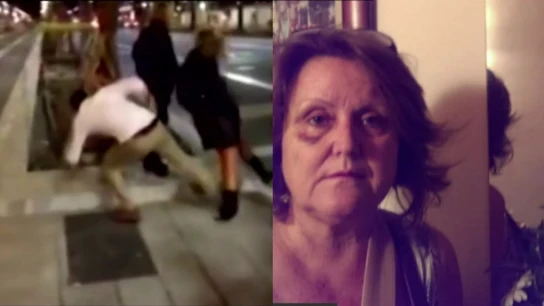 Conchita Colás, víctima del agresor de la patada Conchita Colás, víctima del agresor de la patada